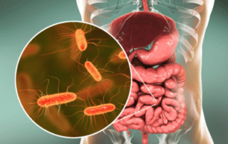 Small Intestinal Bacterial Overgrowth (SIBO)